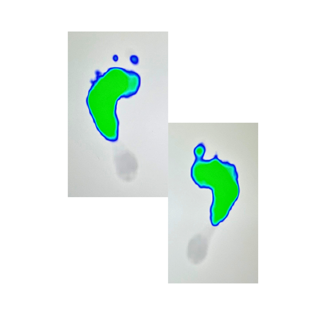 Foot Strength: Why its Essential